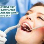 Why To Avoid Dairy After Dental Implant