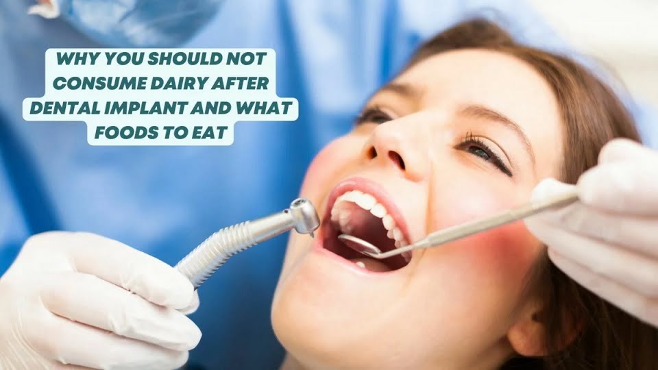 Why To Avoid Dairy After Dental Implant