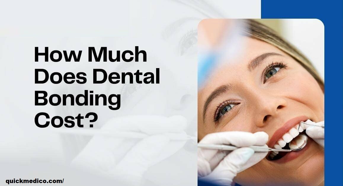 How Much Does Teeth Bonding Cost
