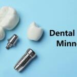 Dental Grants in Minnesota - Access Affordable Dental Care