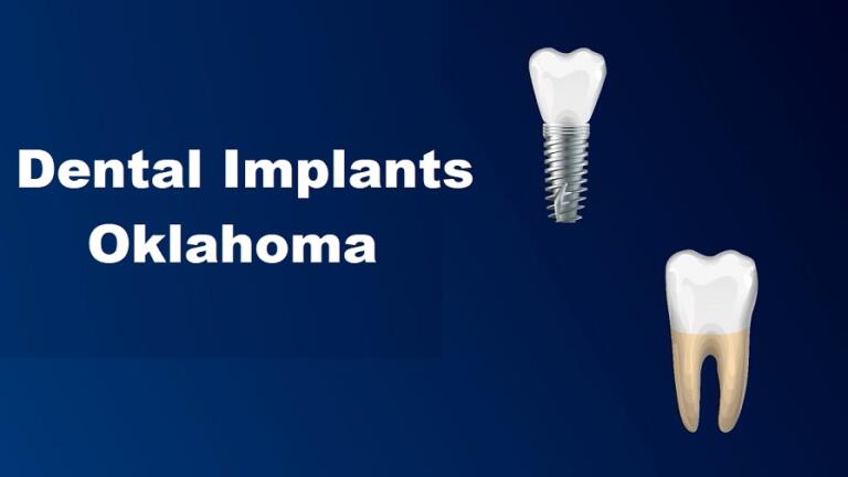 Dental Implants in Oklahoma