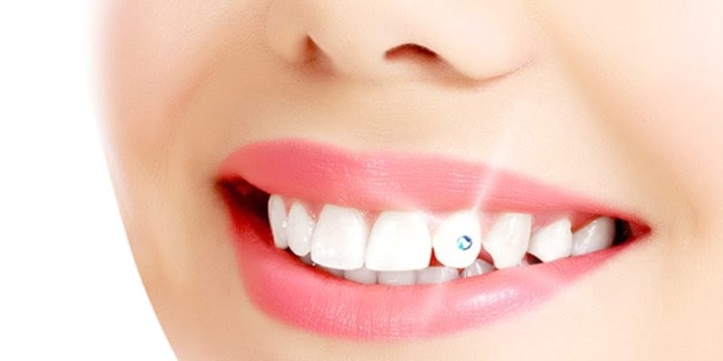 All About Tooth Piercing