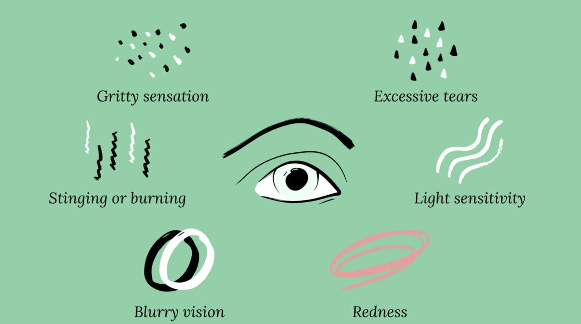 Common Symptoms of Morning Dry Eyes