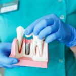Dental Grants for Individuals