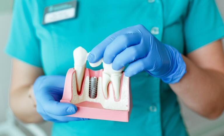 Dental Grants for Individuals
