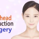 Forehead Reduction Surgery