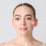 How to Get Rid of Acne Scars Medically or at Home