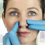 PNasal Septum Deviation