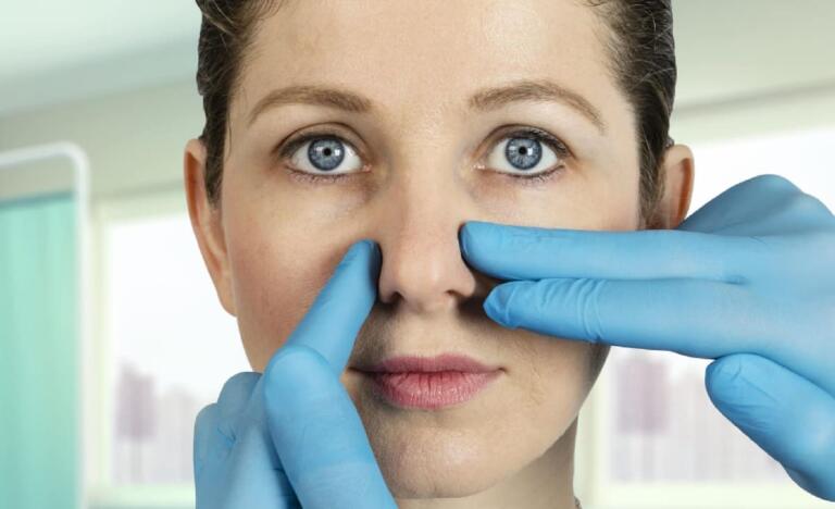 PNasal Septum Deviation