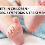 Rickets in Children : Causes, Symptoms & Treatment