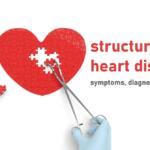 Structural Heart Disease Symptoms, Causes and Treatment