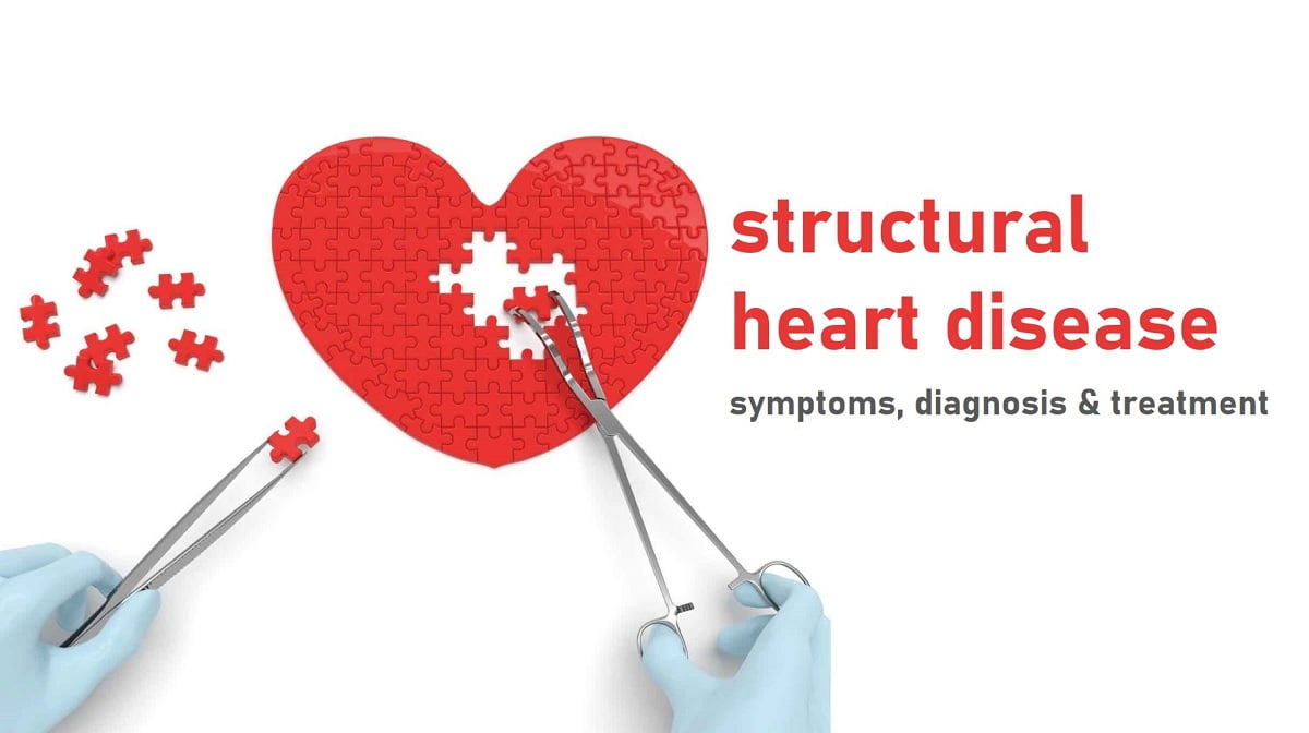 Structural Heart Disease Symptoms, Causes and Treatment