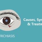 Trichiasis (Ingrown Eyelash): Causes, Symptoms, & Treatment