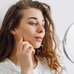 How to Remove Blemishes Fast