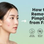 How to Remove Pimples from Face